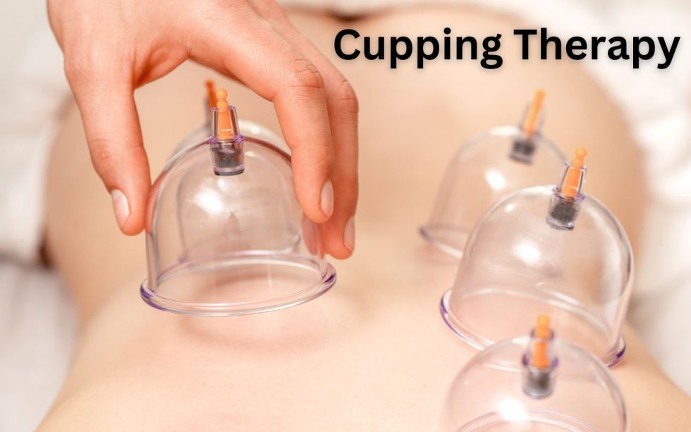 Glass Cupping - Back Pain Treatment
